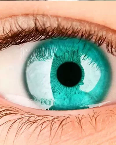 Color of your eyes