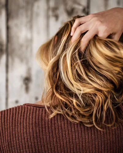 hair loss
