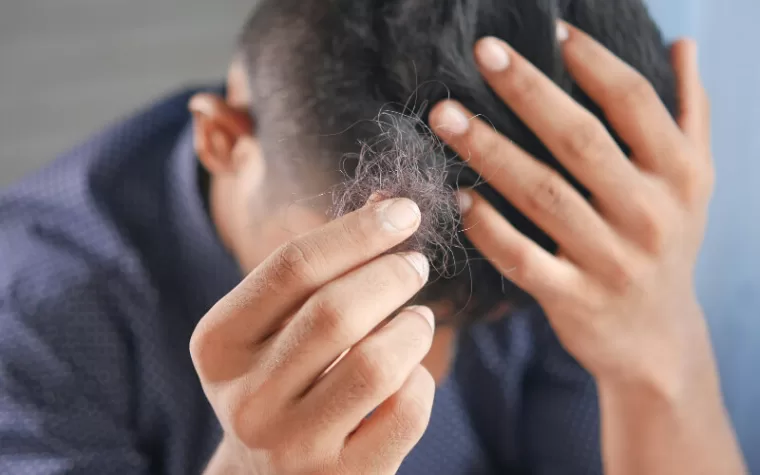 male hair thinning